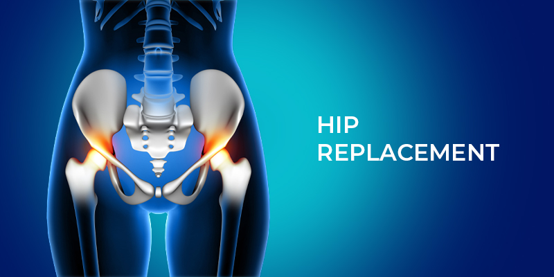 Dr. Ankur Gupta - Best Orthopedic Doctor for Hip Replacement in Raipurh