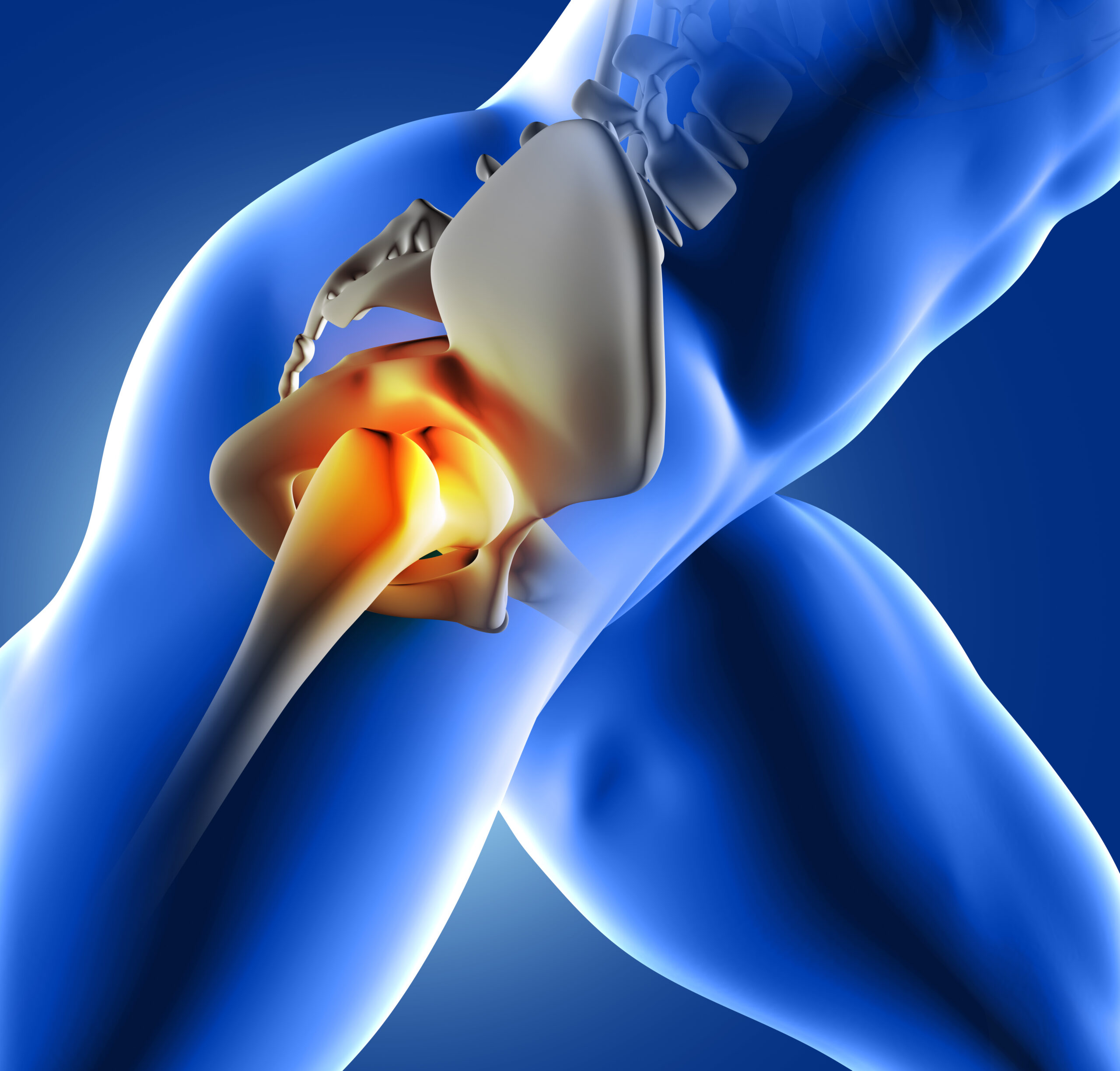 Hip replacement in raipur
