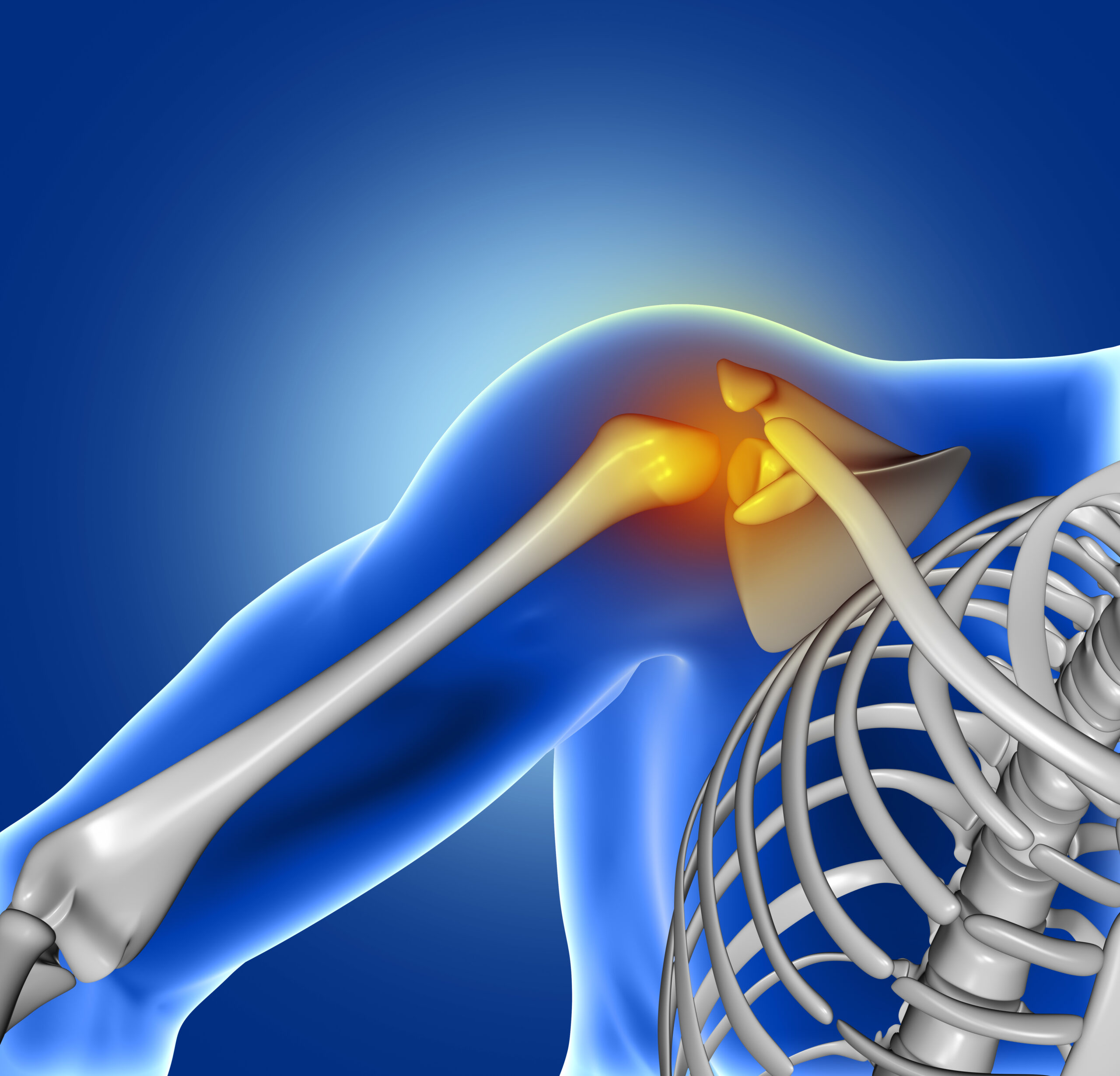 shoulder fracture in Raipur