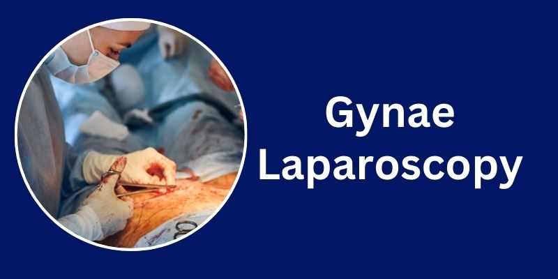 Gynae Laparoscopy