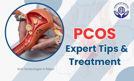 Demystifying PCOS: Expert Tips and Treatment Approaches